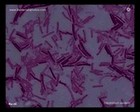 clostridium sordellii under microscope